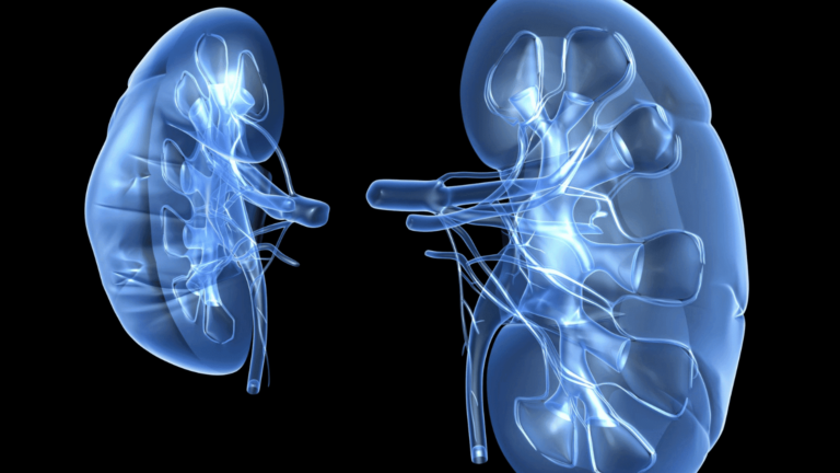 Kidney Infection Symptoms - What Are The Symptoms?